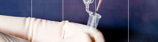 View a sample DNA Test result by easyDNA UK.